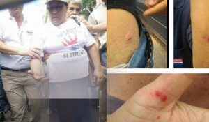 mirian-rojas-con-la-pierna-ensangrentada-y-rastros-de-balines-de-gomas-en-otras-personas-tras-el-enfrentamiento-con-la-policia-frente-a-haciend_892_573_1444434